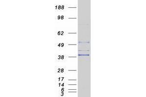Western Blotting (WB) image for 1-Acylglycerol-3-Phosphate O-Acyltransferase 5 (Lysophosphatidic Acid Acyltransferase, Epsilon) (AGPAT5) protein (Myc-DYKDDDDK Tag) (ABIN2714460)
