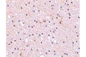 Immunohistochemistry of NCSTN in human brain tissue with NCSTN polyclonal antibody  at 2. (Nicastrin 抗体  (Internal Region))