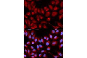 Immunofluorescence analysis of U2OS cell using IL16 antibody. (IL16 抗体)
