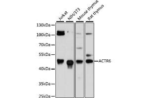 Western blot analysis of extracts of various cell lines, using  antibody (ABIN6133271, ABIN6136499, ABIN6136500 and ABIN6217149) at 1:3000 dilution. (ACTR6 抗体  (AA 237-396))