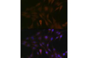 Immunofluorescence analysis of C6 cells using MEK3 Rabbit mAb (ABIN1682965, ABIN3017630, ABIN3017631 and ABIN7101512) at dilution of 1:100 (40x lens). (MAP2K3 抗体)