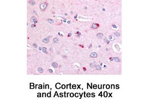 Image no. 1 for anti-Niemann-Pick Disease, Type C1 (NPC1) (C-Term) antibody (ABIN363474) (NPC1 抗体  (C-Term))