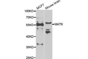 Western blot analysis of extracts of various cell lines, using MATK antibody (ABIN5974003) at 1/1000 dilution. (MATK 抗体)