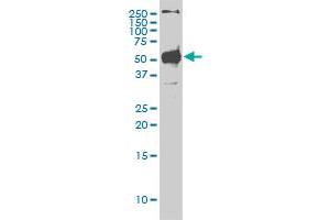 STK38 monoclonal antibody (M01A), clone 2G8-1F3 Western Blot analysis of STK38 expression in Hela S3 NE . (STK38 抗体  (AA 1-465))