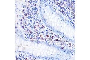 Immunohistochemistry of paraffin-embedded human appendix using Bcl-2 Rabbit pAb (ABIN6134233, ABIN6137496, ABIN6137498 and ABIN6213667) at dilution of 1:100 (40x lens). (Bcl-2 抗体)