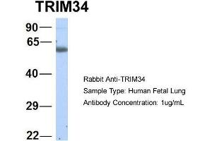 Host:  Rabbit  Target Name:  TRIM34  Sample Type:  Human Fetal Lung  Antibody Dilution:  1. (TRIM34 抗体  (N-Term))