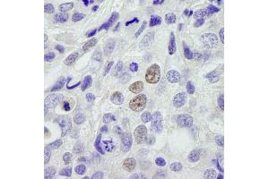 Immunohistochemistry (IHC) image for anti-Cleavage and Polyadenylation Specific Factor 3-Like (CPSF3L) (AA 550-600) antibody (ABIN7448606)