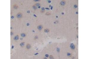 Immunohistochemistry (IHC) image for anti-Succinate Dehydrogenase Complex, Subunit C, Integral Membrane Protein, 15kDa (SDHC) (AA 1-72) antibody (ABIN1870699)