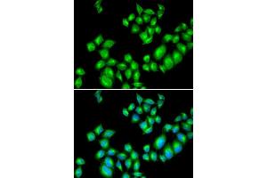 Immunofluorescence analysis of U20S cell using DRD3 antibody. (DRD3 抗体  (AA 213-329))