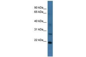 Image no. 1 for anti-StAR-Related Lipid Transfer (START) Domain Containing 4 (STARD4) (AA 96-145) antibody (ABIN6746357) (STARD4 抗体  (AA 96-145))
