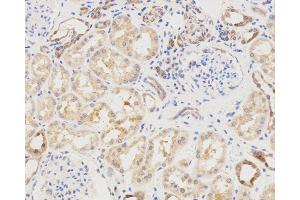 Immunohistochemistry analysis of paraffin-embedded Human spleen using LC3A/B Polyclonal Antibody at dilution of 1:500. (LC3A / LC3B 抗体)