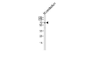 MTF2 anticorps  (AA 289-317)