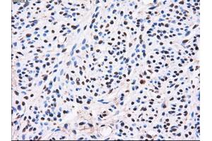 Immunohistochemistry (IHC) image for anti-Aldo-Keto Reductase Family 1, Member A1 (Aldehyde Reductase) (AKR1A1) antibody (ABIN1496547) (AKR1A1 抗体)