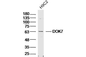 Lane 1: H9C2 lysates probed with DOK7 Polyclonal Antibody, Unconjugated  at 1:300 overnight at 4˚C. (DOK7 抗体  (AA 21-120))