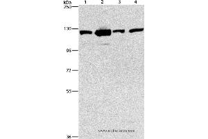 Western blot analysis of 231, NIH/3T3, A431 and hela cell, using PTK2 Polyclonal Antibody at dilution of 1:300 (FAK 抗体)