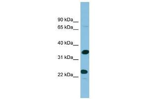 Prodynorphin antibody used at 1 ug/ml to detect target protein. (PDYN 抗体  (Middle Region))