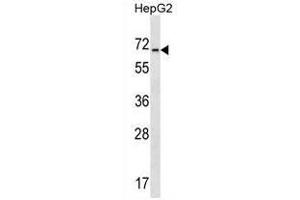 ACCN4 Antibody (ACCN4 抗体  (N-Term))