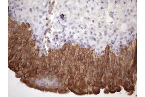 Immunohistochemistry (IHC) image for anti-Amelotin (AMTN) antibody (ABIN2716038) (Amelotin 抗体)