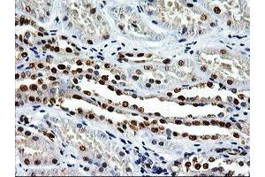 Image no. 2 for anti-EPM2A (Laforin) Interacting Protein 1 (EPM2AIP1) antibody (ABIN1498046) (EPM2AIP1 抗体)