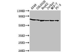Western Blot Positive WB detected in: A549 whole cell lysate, COLO320 whole cell lysate, HepG2 whole cell lysate, Jurkat whole cell lysate, MCF-7 whole cell lysate, PC-3 whole cell lysate All lanes: HSPA1A antibody at 1:2000 Secondary Goat polyclonal to rabbit IgG at 1/50000 dilution Predicted band size: 71, 64 kDa Observed band size: 71 kDa (HSP70 1A 抗体  (AA 291-641))