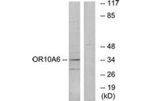 Western blot analysis of extracts from A549 cells, using OR10A6 Antibody. (OR10A6 抗体  (AA 241-290))