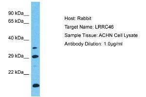 Host: Rabbit Target Name: LRRC46 Sample Type: ACHN Whole Cell lysates Antibody Dilution: 1. (LRRC46 抗体  (C-Term))