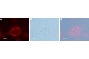 Expression of Pannexin 2 in human U-87 MG glioblastoma cell line - Cell surface detection of Pannexin 2 in live intact human U-87 MG glioblastoma cells. (Pannexin 2 抗体  (1st Extracellular Loop))