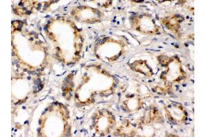 Anti- FXYZ1 Picoband antibody, IHC(P) IHC(P): Human Prostatic Cancer Tissue (FXYD1 抗体  (AA 21-92))