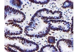 Image no. 5 for anti-Glutathione S-Transferase theta 2 (GSTT2) antibody (ABIN1498553) (GSTT2 抗体)