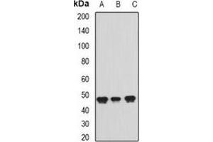 Western blot analysis of ADE2 expression in Jurkat (A), Raji (B), Hela (C) whole cell lysates. (PAICS 抗体)