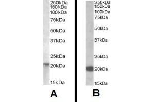 Western Blotting (WB) image for anti-GTPase NRas (NRAS) (Internal Region) antibody (ABIN2466026) (GTPase NRas 抗体  (Internal Region))