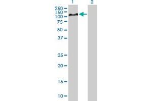 Western Blotting (WB) image for anti-Hypoxia Inducible Factor 1, alpha Subunit (Basic Helix-Loop-Helix Transcription Factor) (HIF1A) (AA 1-735) antibody (ABIN516443)