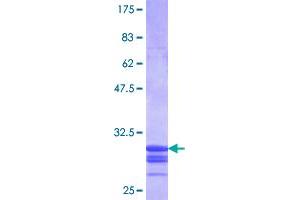 SLC11A1 Protein (AA 308-350) (GST tag)