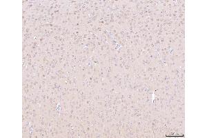 IHC analysis of NDUFB8 using anti-NDUFB8 antibody (ABIN7599048).