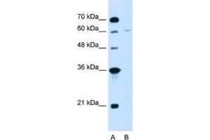 Western Blotting (WB) image for anti-Chromatin Assembly Factor 1, Subunit B (p60) (CHAF1B) antibody (ABIN2462905) (CHAF1B 抗体)