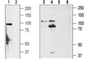 Western blot analysis of rat DRG (lanes 1,2), non-differentiated PC12 cells (lanes 3,5) and differentiated PC12 cells (lanes 4,6) lysates: - 1,3,4. (TRPA1 抗体  (1st Extracellular Loop))