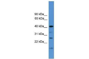 Western Blot showing SCAMP1 antibody used at a concentration of 1-2 ug/ml to detect its target protein. (SCAMP1 抗体  (Middle Region))