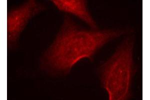 Immunofluorescence (IF) image for anti-Nuclear Factor-kB p65 (NFkBP65) (pSer311) antibody (ABIN1870583) (NF-kB p65 抗体  (pSer311))