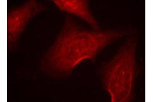 Immunofluorescence (IF) image for anti-Nuclear Factor-kB p65 (NFkBP65) (pSer311) antibody (ABIN1870583) (NF-kB p65 抗体  (pSer311))