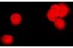 Immunofluorescent analysis of PPP2R4 staining in MCF7 cells. (PPP2R4 抗体)
