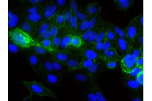 Human epithelial carcinoma cell line HEp-2 was stained with Mouse Anti-Human CD44-FITC followed by DAPI. (CD44 抗体  (FITC))