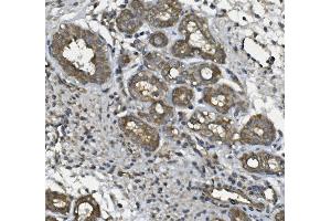 IHC analysis of ULBP1 using anti ULBP1 antibody (ABIN7600996). (ULBP1 抗体  (AA 27-209))
