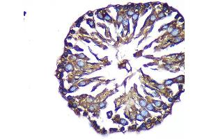 Immunohistochemistry (IHC) image for anti-ARP1 Actin-Related Protein 1 Homolog B, Centractin beta (ACTR1B) (AA 1-105) antibody (ABIN7265675)