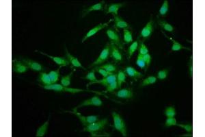 Immunofluorescence staining of Hela cells with ABIN7142099 at 1:225, counter-stained with DAPI. (14-3-3 sigma/SFN 抗体  (AA 1-248))