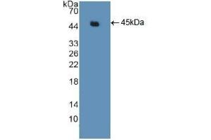 Detection of Recombinant ACTg2, Human using Polyclonal Antibody to Actin Gamma 2, Smooth Muscle (ACTg2) (ACTG2 抗体  (AA 3-376))