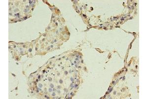 Immunohistochemistry of paraffin-embedded human testis tissue using ABIN7147867 at dilution of 1:100 (Claudin 15 抗体  (AA 72-128))
