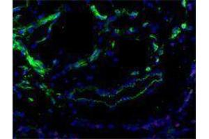 Immunofluorescence (IF) image for anti-Fms-Related Tyrosine Kinase 4 (FLT4) antibody (ABIN2665457) (FLT4 抗体)