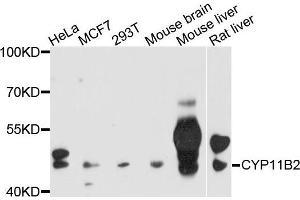 Western blot analysis of extracts of various cells，using CYP11B2 antibody. (CYP11B2 抗体)