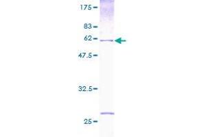 HUS1 Protein (AA 1-280) (GST tag)