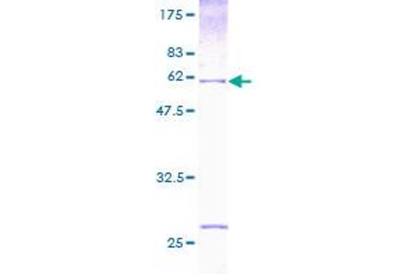 HUS1 Protein (AA 1-280) (GST tag)